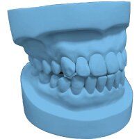 EVO Rock dental plaster blue 5:1 - Size: 5 kg