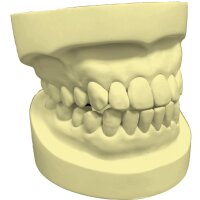 EVO Rock dental plaster light yellow 5:1 - Size: 20 kg