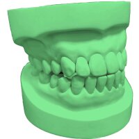 Expansion plaster green - Size: 10 kg