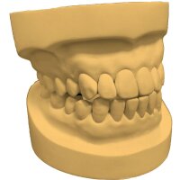 Hardstone 300 synthetic hard plaster yellow - Size: 20 kg