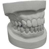 Rock 200 dental plaster grey 5:1 - Size: 5 kg