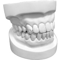 Stone 300 All-round super hard plaster extra white - Size: 5 kg