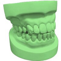 Stone 300 All-round super hard plaster green - Size: 10 kg