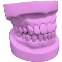 Stone 300 All-round super hard plaster purple - Size: 10 kg