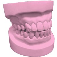 Stone 300 Allround-Superhartgips rosa - Größe: 10 kg